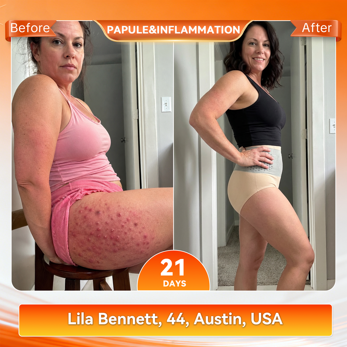 𝐎𝐟𝐟𝐢𝐜𝐢𝐚𝐥 𝐁𝐫𝐚𝐧𝐝 𝐒𝐭𝐨𝐫𝐞 🇺🇸 𝑨𝑳𝑳𝒀𝑩𝑬𝑬® 𝟐𝟎𝟐𝟔 𝐌𝐨𝐫𝐢𝐧𝐠𝐚 & 𝐁𝐞𝐫𝐛𝐞𝐫𝐢𝐧𝐞 𝟒-𝐈𝐧-𝟏 𝐌𝐢𝐜𝐫𝐨-𝐏𝐚𝐫𝐭𝐢𝐜𝐥𝐞 𝐒𝐜𝐮𝐥𝐩𝐭𝐢𝐧𝐠 & 𝐅𝐚𝐭-𝐁𝐮𝐫𝐧 𝐒𝐡𝐨𝐫𝐭𝐬