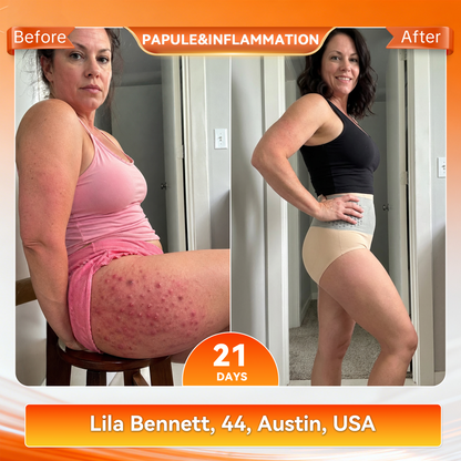 𝐎𝐟𝐟𝐢𝐜𝐢𝐚𝐥 𝐁𝐫𝐚𝐧𝐝 𝐒𝐭𝐨𝐫𝐞 🇺🇸 𝑨𝑳𝑳𝒀𝑩𝑬𝑬® 𝟐𝟎𝟐𝟔 𝐌𝐨𝐫𝐢𝐧𝐠𝐚 & 𝐁𝐞𝐫𝐛𝐞𝐫𝐢𝐧𝐞 𝟒-𝐈𝐧-𝟏 𝐌𝐢𝐜𝐫𝐨-𝐏𝐚𝐫𝐭𝐢𝐜𝐥𝐞 𝐒𝐜𝐮𝐥𝐩𝐭𝐢𝐧𝐠 & 𝐅𝐚𝐭-𝐁𝐮𝐫𝐧 𝐒𝐡𝐨𝐫𝐭𝐬