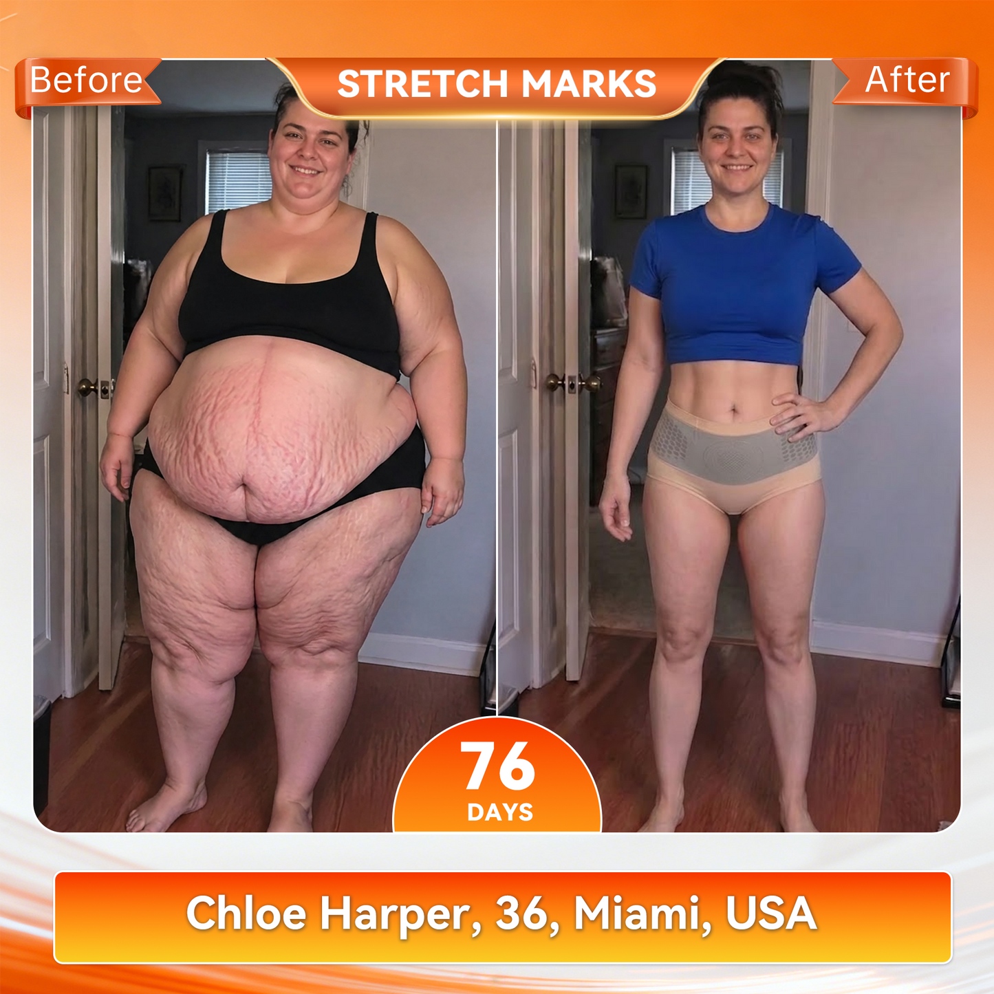 𝐎𝐟𝐟𝐢𝐜𝐢𝐚𝐥 𝐁𝐫𝐚𝐧𝐝 𝐒𝐭𝐨𝐫𝐞 🇺🇸 𝑨𝑳𝑳𝒀𝑩𝑬𝑬® 𝟐𝟎𝟐𝟔 𝐌𝐨𝐫𝐢𝐧𝐠𝐚 & 𝐁𝐞𝐫𝐛𝐞𝐫𝐢𝐧𝐞 𝟒-𝐈𝐧-𝟏 𝐌𝐢𝐜𝐫𝐨-𝐏𝐚𝐫𝐭𝐢𝐜𝐥𝐞 𝐒𝐜𝐮𝐥𝐩𝐭𝐢𝐧𝐠 & 𝐅𝐚𝐭-𝐁𝐮𝐫𝐧 𝐒𝐡𝐨𝐫𝐭𝐬
