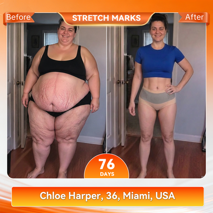 𝐎𝐟𝐟𝐢𝐜𝐢𝐚𝐥 𝐁𝐫𝐚𝐧𝐝 𝐒𝐭𝐨𝐫𝐞 🇺🇸 𝑨𝑳𝑳𝒀𝑩𝑬𝑬® 𝟐𝟎𝟐𝟔 𝐌𝐨𝐫𝐢𝐧𝐠𝐚 & 𝐁𝐞𝐫𝐛𝐞𝐫𝐢𝐧𝐞 𝟒-𝐈𝐧-𝟏 𝐌𝐢𝐜𝐫𝐨-𝐏𝐚𝐫𝐭𝐢𝐜𝐥𝐞 𝐒𝐜𝐮𝐥𝐩𝐭𝐢𝐧𝐠 & 𝐅𝐚𝐭-𝐁𝐮𝐫𝐧 𝐒𝐡𝐨𝐫𝐭𝐬
