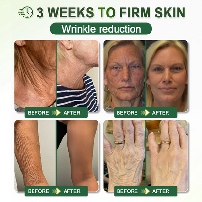 𝐇𝐢𝐬𝐤𝐢𝐧® 𝐏𝐃𝐑𝐍 𝐀𝐧𝐭𝐢-𝐀𝐠𝐢𝐧𝐠 & 𝐓𝐚𝐫𝐠𝐞𝐭𝐞𝐝 𝐒𝐩𝐨𝐭 𝐂𝐚𝐫𝐞(👨‍⚕️ 𝑯𝒆𝒍𝒑𝒔 𝑺𝒎𝒐𝒐𝒕𝒉 𝑾𝒓𝒊𝒏𝒌𝒍𝒆𝒔, 𝑺𝒖𝒑𝒑𝒐𝒓𝒕 𝑭𝒊𝒓𝒎𝒆𝒓-𝑳𝒐𝒐𝒌𝒊𝒏𝒈 𝑺𝒌𝒊𝒏,𝗮𝗻𝗱 𝗜𝗺𝗽𝗿𝗼𝘃𝗲 𝘁𝗵𝗲 𝗔𝗽𝗽𝗲𝗮𝗿𝗮𝗻𝗰𝗲 𝗼𝗳 𝗩𝗶𝘀𝗶𝗯𝗹𝗲 𝗦𝗽𝗼𝘁𝘀 𝗶𝗻 𝟳 𝗗𝗮𝘆𝘀 🕑)