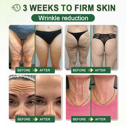 𝐇𝐢𝐬𝐤𝐢𝐧® 𝐏𝐃𝐑𝐍 𝐀𝐧𝐭𝐢-𝐀𝐠𝐢𝐧𝐠 & 𝐓𝐚𝐫𝐠𝐞𝐭𝐞𝐝 𝐒𝐩𝐨𝐭 𝐂𝐚𝐫𝐞(👨‍⚕️ 𝑯𝒆𝒍𝒑𝒔 𝑺𝒎𝒐𝒐𝒕𝒉 𝑾𝒓𝒊𝒏𝒌𝒍𝒆𝒔, 𝑺𝒖𝒑𝒑𝒐𝒓𝒕 𝑭𝒊𝒓𝒎𝒆𝒓-𝑳𝒐𝒐𝒌𝒊𝒏𝒈 𝑺𝒌𝒊𝒏,𝗮𝗻𝗱 𝗜𝗺𝗽𝗿𝗼𝘃𝗲 𝘁𝗵𝗲 𝗔𝗽𝗽𝗲𝗮𝗿𝗮𝗻𝗰𝗲 𝗼𝗳 𝗩𝗶𝘀𝗶𝗯𝗹𝗲 𝗦𝗽𝗼𝘁𝘀 𝗶𝗻 𝟳 𝗗𝗮𝘆𝘀 🕑)