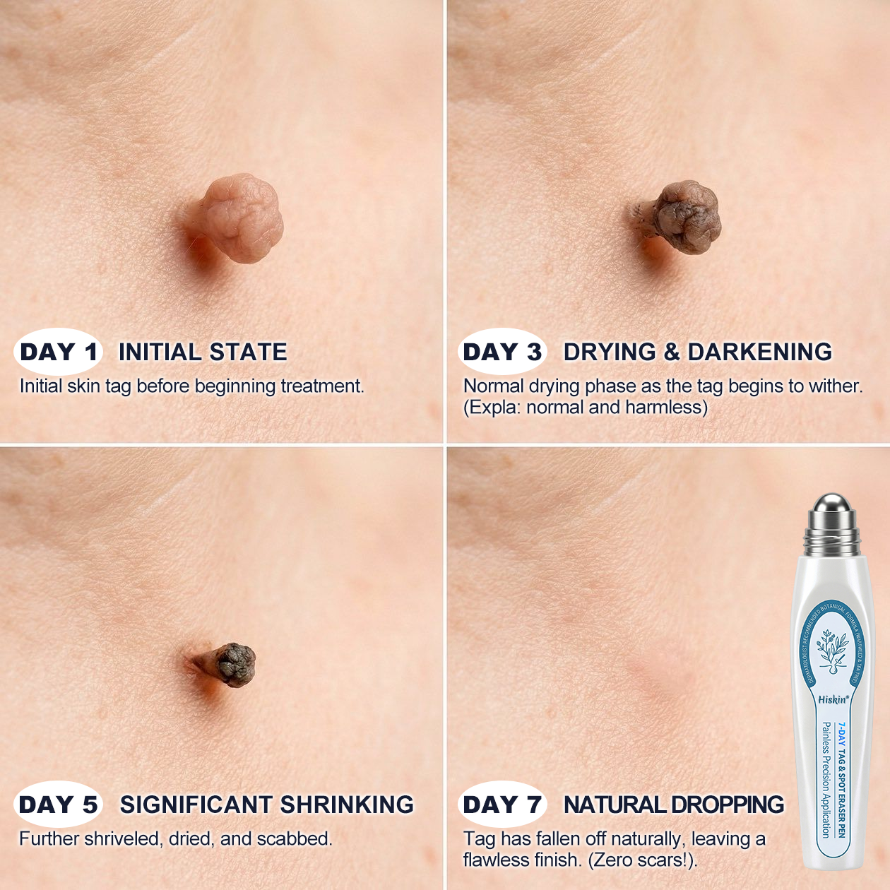 𝐇𝐢𝐬𝐤𝐢𝐧®CareUplift® 🎁ABSOLUTE MADNESS! 50% OFF — EVEN WE CAN’T BELIEVE WE’RE DOING THIS!🎁