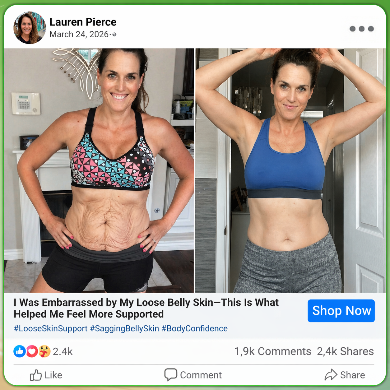 𝐂𝐚𝐫𝐞𝐔𝐩𝐥𝐢𝐟𝐭® 𝑴𝒆𝒕𝒂𝒃𝒐𝒍𝒊𝒄 𝑵𝒂𝒏𝒐 𝑴𝒊𝒄𝒓𝒐𝒏𝒆𝒆𝒅𝒍𝒆 𝑷𝒂𝒕𝒄𝒉🇺🇸(𝐉𝐮𝐬𝐭 𝐨𝐧𝐜𝐞 𝐚 𝐝𝐚𝐲, 𝐯𝐢𝐬𝐢𝐛𝐥𝐞 𝐜𝐡𝐚𝐧𝐠𝐞𝐬 𝐢𝐧 𝟕 𝐝𝐚𝐲𝐬）𝘽𝙚𝙧𝙗𝙚𝙧𝙞𝙣𝙚 + 𝙈𝙤𝙧𝙞𝙣𝙜𝙖 𝙁𝙤𝙧𝙢𝙪𝙡𝙖 ✅ 𝐅𝐨𝐫 𝐨𝐛𝐞𝐬𝐢𝐭𝐲, 𝗟𝗼𝗼𝘀𝗲 𝘀𝗸𝗶𝗻,𝐝𝐢𝐚𝐛𝐞𝐭𝐞𝐬, 𝐬𝐥𝐞𝐞𝐩 𝐚𝐩𝐧𝐞𝐚, 𝐣𝐨𝐢𝐧𝐭 𝐢𝐬𝐬𝐮𝐞𝐬, 𝐚𝐧𝐝 𝐦𝐨𝐫𝐞 💯💯