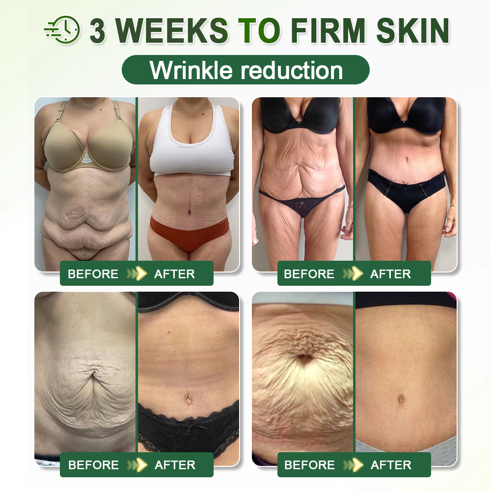 𝐇𝐢𝐬𝐤𝐢𝐧® 𝐏𝐃𝐑𝐍 𝐀𝐧𝐭𝐢-𝐀𝐠𝐢𝐧𝐠 & 𝐓𝐚𝐫𝐠𝐞𝐭𝐞𝐝 𝐒𝐩𝐨𝐭 𝐂𝐚𝐫𝐞(👨‍⚕️ 𝑯𝒆𝒍𝒑𝒔 𝑺𝒎𝒐𝒐𝒕𝒉 𝑾𝒓𝒊𝒏𝒌𝒍𝒆𝒔, 𝑺𝒖𝒑𝒑𝒐𝒓𝒕 𝑭𝒊𝒓𝒎𝒆𝒓-𝑳𝒐𝒐𝒌𝒊𝒏𝒈 𝑺𝒌𝒊𝒏,𝗮𝗻𝗱 𝗜𝗺𝗽𝗿𝗼𝘃𝗲 𝘁𝗵𝗲 𝗔𝗽𝗽𝗲𝗮𝗿𝗮𝗻𝗰𝗲 𝗼𝗳 𝗩𝗶𝘀𝗶𝗯𝗹𝗲 𝗦𝗽𝗼𝘁𝘀 𝗶𝗻 𝟳 𝗗𝗮𝘆𝘀 🕑)