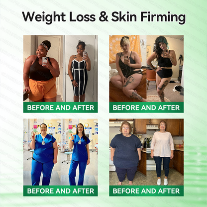 🎀🎀 𝐂𝐚𝐫𝐞𝐔𝐩𝐥𝐢𝐟𝐭® 𝑴𝒆𝒕𝒂𝒃𝒐𝒍𝒊𝒄 𝑵𝒂𝒏𝒐 𝑴𝒊𝒄𝒓𝒐𝒏𝒆𝒆𝒅𝒍𝒆 𝑷𝒂𝒕𝒄𝒉🇺🇸(𝐉𝐮𝐬𝐭 𝐨𝐧𝐜𝐞 𝐚 𝐝𝐚𝐲, 𝐯𝐢𝐬𝐢𝐛𝐥𝐞 𝐜𝐡𝐚𝐧𝐠𝐞𝐬 𝐢𝐧 𝟕 𝐝𝐚𝐲𝐬）𝘽𝙚𝙧𝙗𝙚𝙧𝙞𝙣𝙚 + 𝙈𝙤𝙧𝙞𝙣𝙜𝙖 𝙁𝙤𝙧𝙢𝙪𝙡𝙖 ✅ 𝐅𝐨𝐫 𝐨𝐛𝐞𝐬𝐢𝐭𝐲, 𝗟𝗼𝗼𝘀𝗲 𝘀𝗸𝗶𝗻,𝐝𝐢𝐚𝐛𝐞𝐭𝐞𝐬, 𝐬𝐥𝐞𝐞𝐩 𝐚𝐩𝐧𝐞𝐚, 𝐣𝐨𝐢𝐧𝐭 𝐢𝐬𝐬𝐮𝐞𝐬, 𝐚𝐧𝐝 𝐦𝐨𝐫𝐞 💯💯