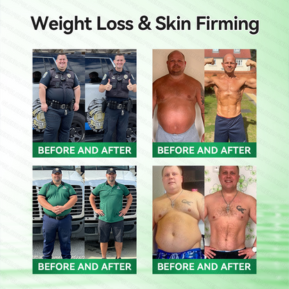 🎀🎀 𝐂𝐚𝐫𝐞𝐔𝐩𝐥𝐢𝐟𝐭® 𝑴𝒆𝒕𝒂𝒃𝒐𝒍𝒊𝒄 𝑵𝒂𝒏𝒐 𝑴𝒊𝒄𝒓𝒐𝒏𝒆𝒆𝒅𝒍𝒆 𝑷𝒂𝒕𝒄𝒉🇺🇸(𝐉𝐮𝐬𝐭 𝐨𝐧𝐜𝐞 𝐚 𝐝𝐚𝐲, 𝐯𝐢𝐬𝐢𝐛𝐥𝐞 𝐜𝐡𝐚𝐧𝐠𝐞𝐬 𝐢𝐧 𝟕 𝐝𝐚𝐲𝐬）𝘽𝙚𝙧𝙗𝙚𝙧𝙞𝙣𝙚 + 𝙈𝙤𝙧𝙞𝙣𝙜𝙖 𝙁𝙤𝙧𝙢𝙪𝙡𝙖 ✅ 𝐅𝐨𝐫 𝐨𝐛𝐞𝐬𝐢𝐭𝐲, 𝗟𝗼𝗼𝘀𝗲 𝘀𝗸𝗶𝗻,𝐝𝐢𝐚𝐛𝐞𝐭𝐞𝐬, 𝐬𝐥𝐞𝐞𝐩 𝐚𝐩𝐧𝐞𝐚, 𝐣𝐨𝐢𝐧𝐭 𝐢𝐬𝐬𝐮𝐞𝐬, 𝐚𝐧𝐝 𝐦𝐨𝐫𝐞 💯💯