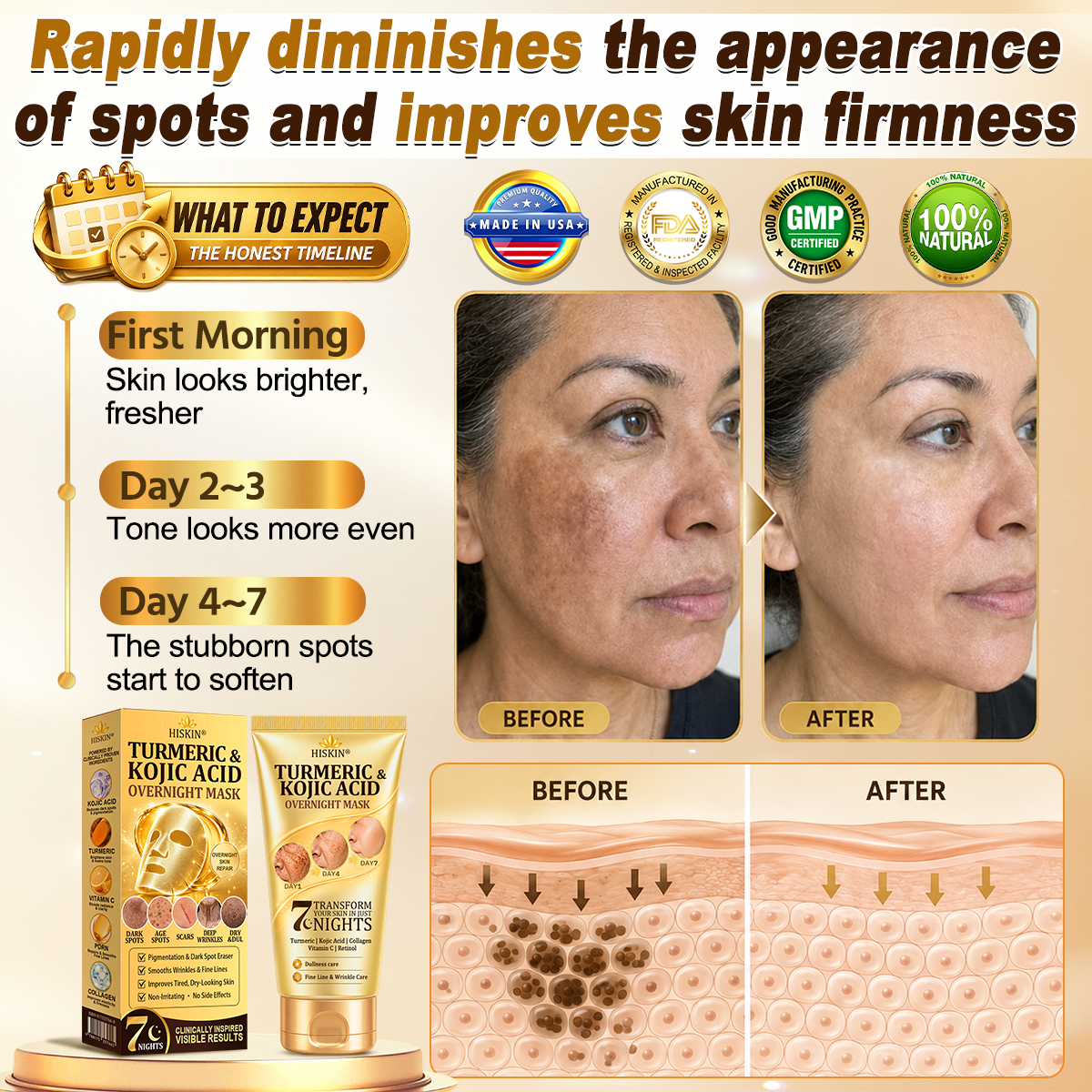 𝑶𝒇𝒇𝒊𝒄𝒊𝒂𝒍 𝑺𝒕𝒐𝒓𝒆 | 𝐍𝐞𝐰! ✨ 𝐇𝐢𝐬𝐤𝐢𝐧® 𝐓𝐮𝐫𝐦𝐞𝐫𝐢𝐜 × 𝐊𝐨𝐣𝐢𝐜 𝐀𝐜𝐢𝐝 𝐎𝐯𝐞𝐫𝐧𝐢𝐠𝐡𝐭 𝐏𝐞𝐞𝐥-𝐎𝐟𝐟 𝐌𝐚𝐬𝐤 — 𝐅𝐚𝐝𝐞 𝐒𝐭𝐮𝐛𝐛𝐨𝐫𝐧 𝐃𝐚𝐫𝐤 𝐒𝐩𝐨𝐭𝐬 & 𝐒𝐦𝐨𝐨𝐭𝐡 𝐕𝐢𝐬𝐢𝐛𝐥𝐞 𝐖𝐫𝐢𝐧𝐤𝐥𝐞𝐬 𝐖𝐡𝐢𝐥𝐞 𝐘𝐨𝐮 𝐒𝐥𝐞𝐞𝐩 🌙✨ 𝐓𝐮𝐫𝐦𝐞𝐫𝐢𝐜 × 𝐊𝐨𝐣𝐢𝐜 𝐀𝐜𝐢𝐝 × 𝐏𝐞𝐩𝐭𝐢𝐝𝐞𝐬 ✅ 𝐎𝐧𝐞 𝐒𝐭𝐞𝐩 𝐚 𝐍𝐢𝐠𝐡𝐭 · 𝐕𝐢𝐬𝐢𝐛𝐥𝐞 𝐂𝐡𝐚𝐧𝐠𝐞𝐬 𝐢𝐧 𝟕 𝐍𝐢𝐠𝐡𝐭𝐬 💯