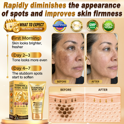 𝑶𝒇𝒇𝒊𝒄𝒊𝒂𝒍 𝑺𝒕𝒐𝒓𝒆 | 𝐍𝐞𝐰! ✨ 𝐇𝐢𝐬𝐤𝐢𝐧® 𝐓𝐮𝐫𝐦𝐞𝐫𝐢𝐜 × 𝐊𝐨𝐣𝐢𝐜 𝐀𝐜𝐢𝐝 𝐎𝐯𝐞𝐫𝐧𝐢𝐠𝐡𝐭 𝐏𝐞𝐞𝐥-𝐎𝐟𝐟 𝐌𝐚𝐬𝐤 — 𝐅𝐚𝐝𝐞 𝐒𝐭𝐮𝐛𝐛𝐨𝐫𝐧 𝐃𝐚𝐫𝐤 𝐒𝐩𝐨𝐭𝐬 & 𝐒𝐦𝐨𝐨𝐭𝐡 𝐕𝐢𝐬𝐢𝐛𝐥𝐞 𝐖𝐫𝐢𝐧𝐤𝐥𝐞𝐬 𝐖𝐡𝐢𝐥𝐞 𝐘𝐨𝐮 𝐒𝐥𝐞𝐞𝐩 🌙✨ 𝐓𝐮𝐫𝐦𝐞𝐫𝐢𝐜 × 𝐊𝐨𝐣𝐢𝐜 𝐀𝐜𝐢𝐝 × 𝐏𝐞𝐩𝐭𝐢𝐝𝐞𝐬 ✅ 𝐎𝐧𝐞 𝐒𝐭𝐞𝐩 𝐚 𝐍𝐢𝐠𝐡𝐭 · 𝐕𝐢𝐬𝐢𝐛𝐥𝐞 𝐂𝐡𝐚𝐧𝐠𝐞𝐬 𝐢𝐧 𝟕 𝐍𝐢𝐠𝐡𝐭𝐬 💯