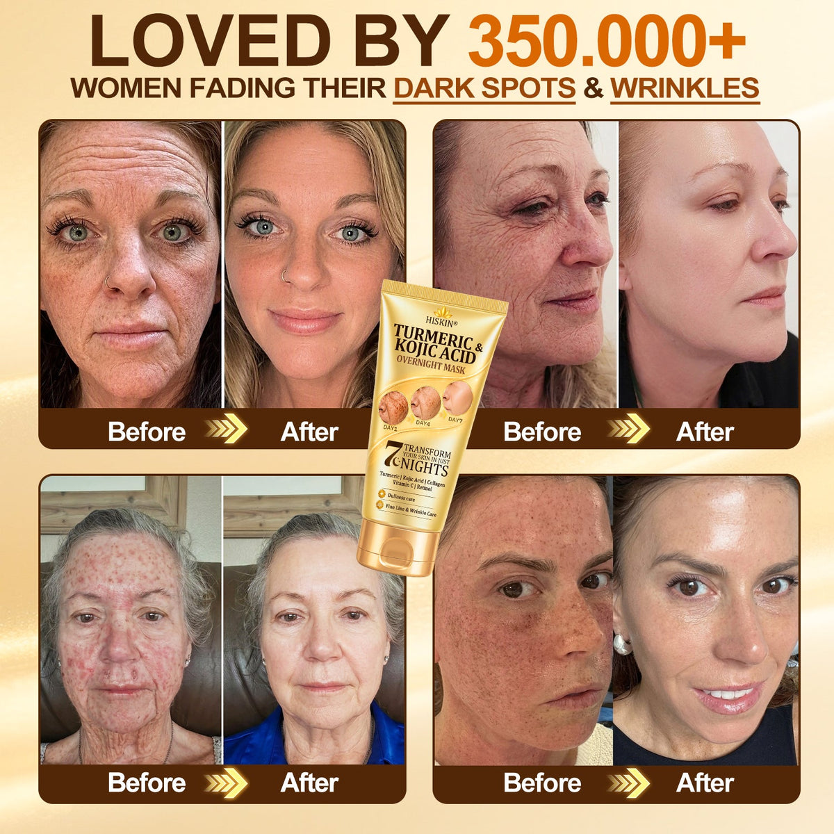 𝑶𝒇𝒇𝒊𝒄𝒊𝒂𝒍 𝑺𝒕𝒐𝒓𝒆 | 𝐍𝐞𝐰! ✨ 𝐇𝐢𝐬𝐤𝐢𝐧® 𝐓𝐮𝐫𝐦𝐞𝐫𝐢𝐜 × 𝐊𝐨𝐣𝐢𝐜 𝐀𝐜𝐢𝐝 𝐎𝐯𝐞𝐫𝐧𝐢𝐠𝐡𝐭 𝐏𝐞𝐞𝐥-𝐎𝐟𝐟 𝐌𝐚𝐬𝐤 — 𝐅𝐚𝐝𝐞 𝐒𝐭𝐮𝐛𝐛𝐨𝐫𝐧 𝐃𝐚𝐫𝐤 𝐒𝐩𝐨𝐭𝐬 & 𝐒𝐦𝐨𝐨𝐭𝐡 𝐕𝐢𝐬𝐢𝐛𝐥𝐞 𝐖𝐫𝐢𝐧𝐤𝐥𝐞𝐬 𝐖𝐡𝐢𝐥𝐞 𝐘𝐨𝐮 𝐒𝐥𝐞𝐞𝐩 🌙✨ 𝐓𝐮𝐫𝐦𝐞𝐫𝐢𝐜 × 𝐊𝐨𝐣𝐢𝐜 𝐀𝐜𝐢𝐝 × 𝐏𝐞𝐩𝐭𝐢𝐝𝐞𝐬 ✅ 𝐎𝐧𝐞 𝐒𝐭𝐞𝐩 𝐚 𝐍𝐢𝐠𝐡𝐭 · 𝐕𝐢𝐬𝐢𝐛𝐥𝐞 𝐂𝐡𝐚𝐧𝐠𝐞𝐬 𝐢𝐧 𝟕 𝐍𝐢𝐠𝐡𝐭𝐬 💯