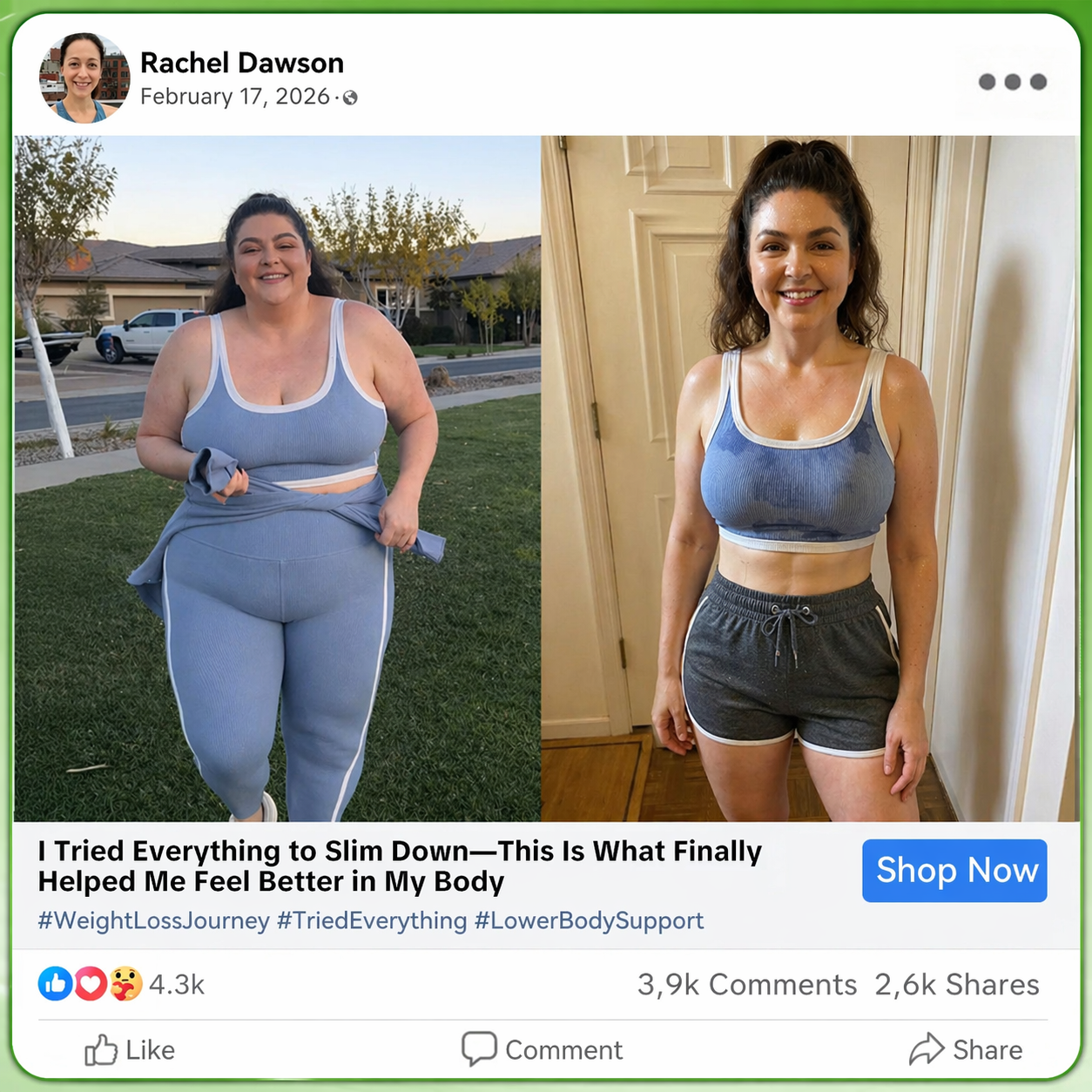 𝐂𝐚𝐫𝐞𝐔𝐩𝐥𝐢𝐟𝐭® 𝑴𝒆𝒕𝒂𝒃𝒐𝒍𝒊𝒄 𝑵𝒂𝒏𝒐 𝑴𝒊𝒄𝒓𝒐𝒏𝒆𝒆𝒅𝒍𝒆 𝑷𝒂𝒕𝒄𝒉🇺🇸(𝐉𝐮𝐬𝐭 𝐨𝐧𝐜𝐞 𝐚 𝐝𝐚𝐲, 𝐯𝐢𝐬𝐢𝐛𝐥𝐞 𝐜𝐡𝐚𝐧𝐠𝐞𝐬 𝐢𝐧 𝟕 𝐝𝐚𝐲𝐬）𝘽𝙚𝙧𝙗𝙚𝙧𝙞𝙣𝙚 + 𝙈𝙤𝙧𝙞𝙣𝙜𝙖 𝙁𝙤𝙧𝙢𝙪𝙡𝙖 ✅ 𝐅𝐨𝐫 𝐨𝐛𝐞𝐬𝐢𝐭𝐲, 𝗟𝗼𝗼𝘀𝗲 𝘀𝗸𝗶𝗻,𝐝𝐢𝐚𝐛𝐞𝐭𝐞𝐬, 𝐬𝐥𝐞𝐞𝐩 𝐚𝐩𝐧𝐞𝐚, 𝐣𝐨𝐢𝐧𝐭 𝐢𝐬𝐬𝐮𝐞𝐬, 𝐚𝐧𝐝 𝐦𝐨𝐫𝐞 💯💯